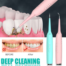 Load image into Gallery viewer, Electric Sonic Oral Irrigator - Dental Scaler - Tooth Calculus Tartar Remover - Healthy Gums - Whitener - Teeth Cleaner